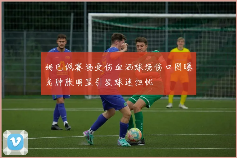 姆巴佩赛场受伤血洒球场伤口图曝光肿胀明显引发球迷担忧